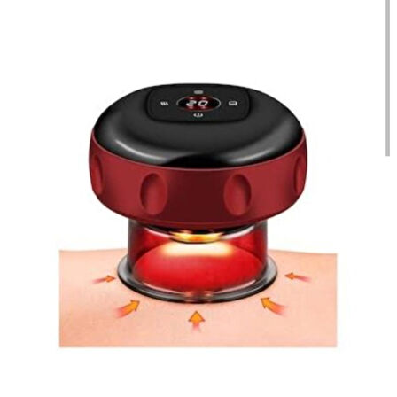 Vakumlu Hacamat Kupası, Şarjlı Kupa Çekme Hacamat Led Işıklı Masaj ve Selülit Kupası