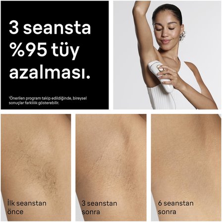 Braun IPL Silk·expert Pro 5, Evde Lazerle Tüy Alma, Çanta, Gillette Venus, 2 Başlık, PL5234