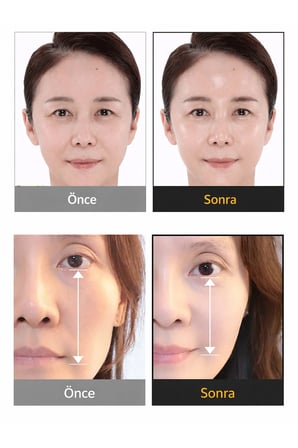 Silk Peptide Intensive Lifting Cream / İpek Peptit Yoğun Sıkılaştırıcı Krem