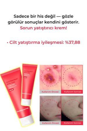 Sungboon Red Heartleaf BHA-Lino Relief Cream - Yatıştırıcı Krem