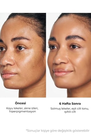 Sungboon Kojic Acid Niacinamide Cleanser - Aydınlatıcı Temizleme Jeli