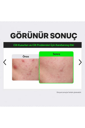 Fation Rapid Calming Barrier Krem Vücut Nemlendirici 45ml