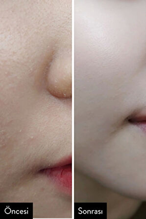 Aha Bha Pha 30 Days Miracle Cream Onarıcı Centella Kremi 60gr