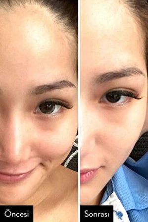 I'm From Rice toner 30 ML Aydınlatıcı Pirinç Toniği 30ML Mini Boy Tüm Cilt Tipleri İçin Niacinamide Etkili