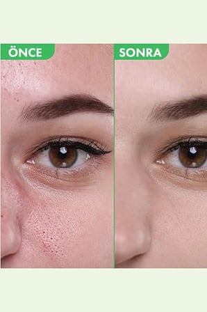 Green Tomato Toner - Yeşil Domates Özlü Arındırıcı Tonik
