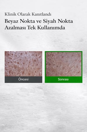 Fully Green Tomato Clay Mask Cleanser Yüz Maskesi 120 ml