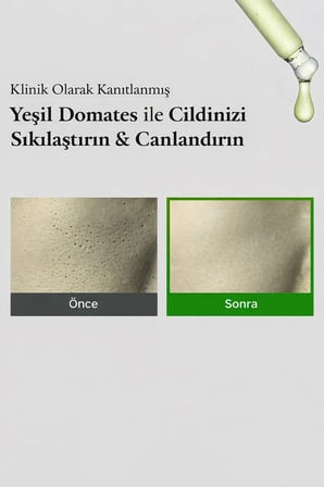 Green Tomato Serum - %67 Yeşil Domates Özlü Gözenek Arındırıcı Serum