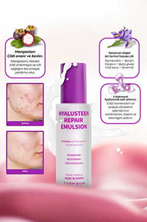 Hyalusteen Repair Emulsion Cilt Nemlendirici Onarıcı Ve Yenileyici Emülsiyon Krem Kore 120ml