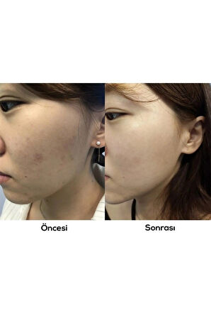 AXIS-Y Dark Spot Correcting Glow Serum 50 ml Leke Karşıtı Işıltı Veren Niacinamide Cilt Serumu