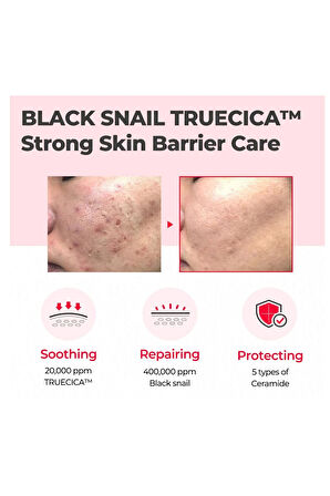 SOMEBYMI Snail Truecica Miracle Repair Cream 60g