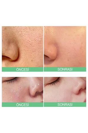 Tomato Gözenek Sıkılaştırıcı Ampul Serum 75 ml
