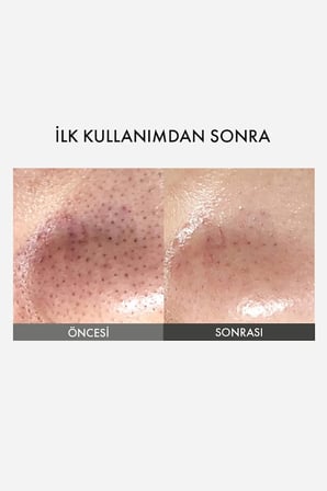 Blackhead Melting Clear Pad / Sebum ve Siyah Nokta Temizleyici Burun Bandı
