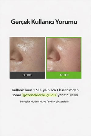 Green Tomato Gözenek Arındırıcı Peeling Pedi 60 Adet