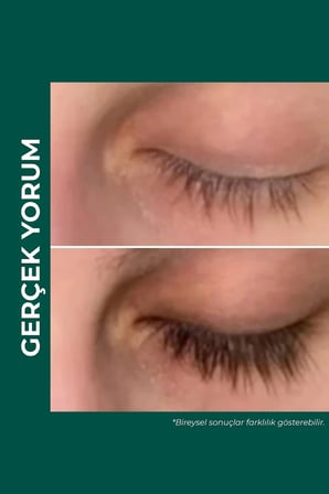 ViveLab Revive Therapy Saç Serumu Kirpik Kaş 4 Gr Peptit Biotin Panthenol