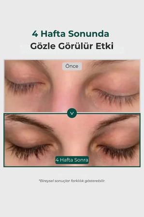 ViveLab Revive Therapy Saç Serumu Kirpik Kaş 4 Gr Peptit Biotin Panthenol