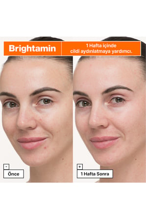 Brightamin Aydınlatıcı Ampul Serum 8.08GM/.28OZ