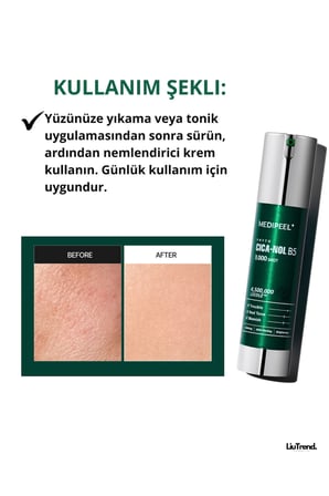 MEDIPEEL Phyto Cica-nol B5 3000 Shot Serum 50 ml Spikül Ve Centella Içeren Serumu M0408
