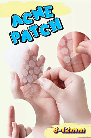 Sos Band Acil Durum Bandı 144 Adet Akne Sivilce Bandı Acne Patch XL144