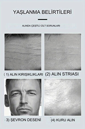 5 Adet Alın ve Kaş Ortası Bölgesi Kolajen Maske T Maske Açık Alan Bol Kolajen Maskesi XLM9117