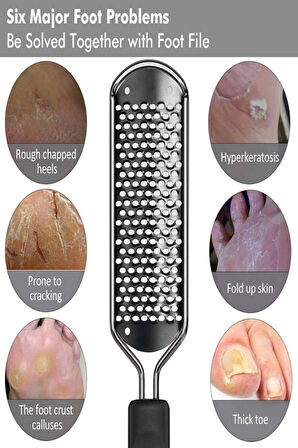 Ayak Tabanı Bakım Törpüsü Topuk Nasır Temizleme Rendesi Inox Çelik Paslanmaz XL72