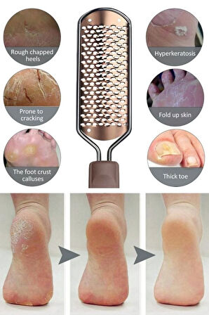 Ayak Tabanı Bakım Törpüsü Topuk Nasır Temizleme Rendesi Inox Çelik Paslanmaz XL72