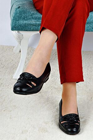 Topuk Dikenine Özel Siyah Yazlık Ortopedik Deri Taban Babet Anne Ayakkabısı