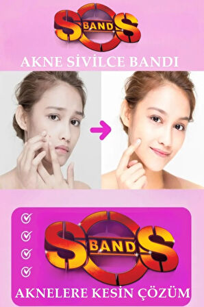 SOS Bant Akne Bandı Acne Patch Sivilce 36 Adet Acil Durum Bandı