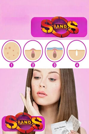 SOS Bant Akne Bandı Acne Patch Sivilce 36 Adet Acil Durum Bandı