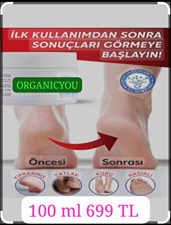 ORGANICYOU AYAK BAKIM ve ÇATLAK & KOKU BIOTERAPİ KREMİ 100 ML