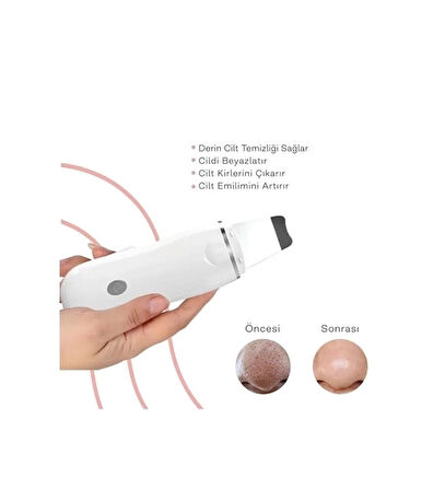 Ultrasonik Spatula Yüz Akne Giderici Siyah Nokta Temizleme Cihazı