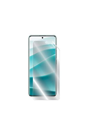 Xiaomi Redmi Note 14 Pro için IPG Hydrogel Ekran Koruyucu