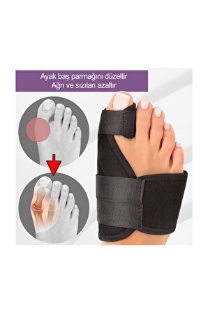 Halluks Valgus Gece Ateli Hallux Valgus Düzeltici Tedavi Ayak Başparmak Kemiği Çıkıntısı Bunyonu