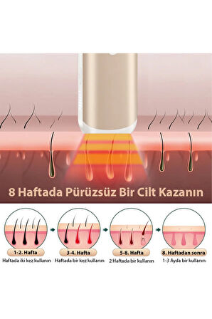 Otomatik atımlı Acısız lazer epilasyon aleti siyah ten kullanımına uygun lazer epilatör