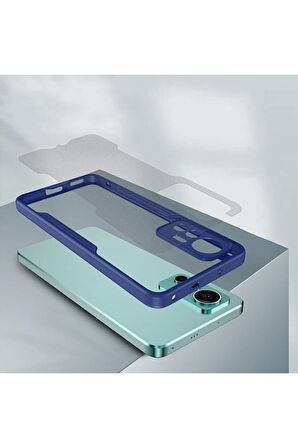 Xiaomi Mi 12 Pro Ile Uyumlu Kılıf Pastel Renki Şeffaf Ultra Ince Hafif Telefon Kılıfı Kapak