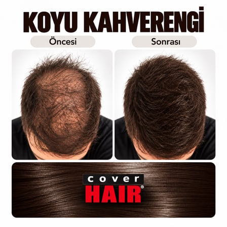Cover Hair Koyu Kahverengi 14 Gram Saç Fiberi Dolgunlaştırıcı Kellik Kapatıcı Toz (Topik Tozu)