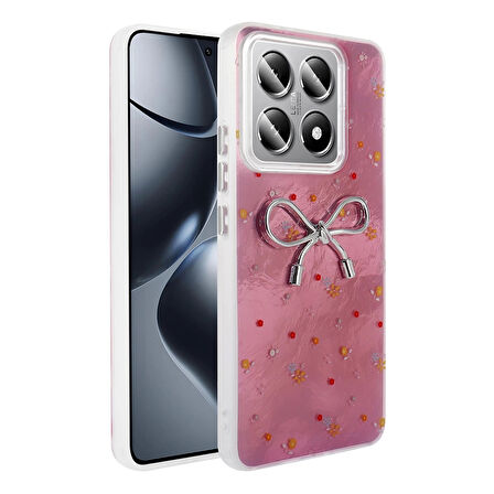 Xiaomi 14t Pro Kılıf Kamera Korumalı Figürlü Lopard Ponti Silikon Kapak