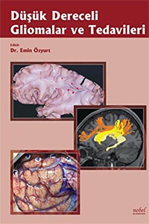 Düşük Dereceli Gliomalar ve Tedavileri / Dr. Emin Özyurt