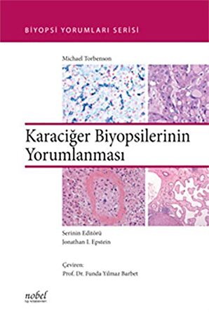 Karaciğer Biyopsilerinin Yorumlanması