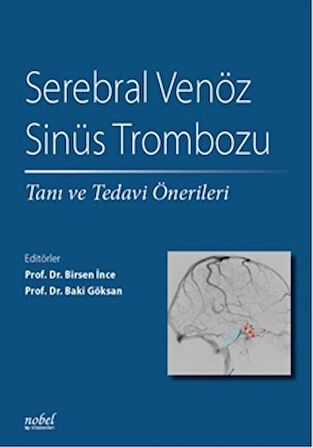 Serebral Venöz Sinüs Trombozu