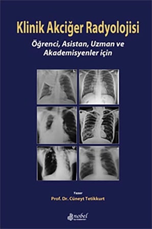 Klinik Akciğer Radyolojisi: Öğrenci, Asistan, Uzman ve Akademisyenler için / Prof. Dr. Cüneyt Tetikkurt