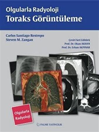 Olgularla Radyoloji Toraks Görüntüleme