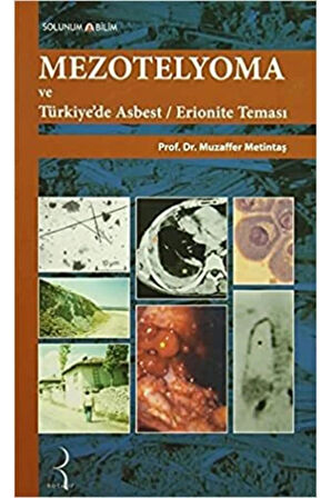 Mezotelyoma ve Türkiye'de Asbest / Erionite Teması