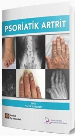 Psoriatik Artrit / Prof. Dr. Kemal Nas