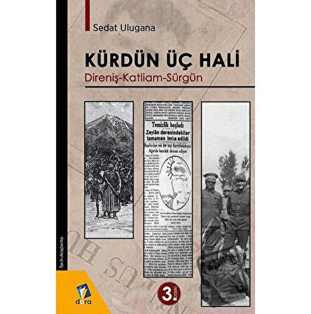 Kürdün Üç Hali