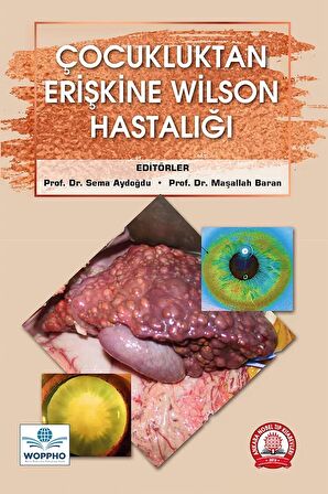 Çocukluktan Erişkine Wilson Hastalığı