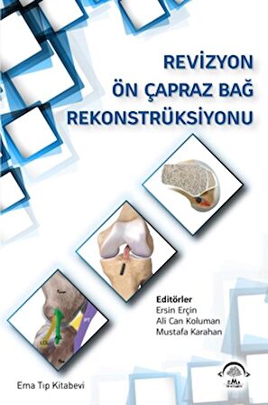 Revizyon Ön Çapraz Bağ Rekonstrüksiyonu