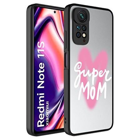 Xiaomi Redmi Note 11 Global Kılıf Aynalı Desenli Kamera Korumalı Parlak  Mirror Kapak
