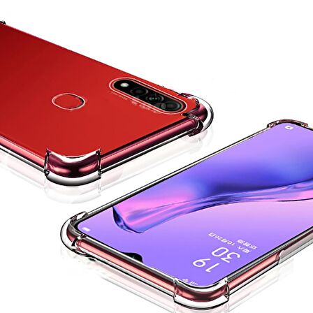 Gpack Oppo A31 Kılıf AntiShock Ultra Koruma Sert Kapak