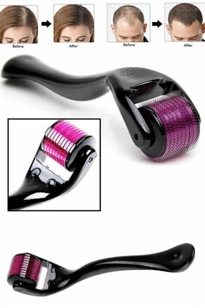 Hediye Derma Roller Titanyum Uçlu 540 İğneli 1 Mm Saç Sakal Çıkarma Ve Cilt Bakım Masaj Aleti