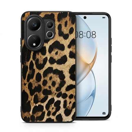 Vivo X200 FE Kılıf Leopar Desenli Lüks Tasarım Esnek ve Dayanıklı Arka Kapak